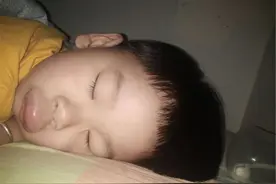 男童被蚊子叮咬后变成“香肠嘴”，妈妈很心疼：差点没认出来图片