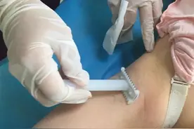 宝妈吐槽分娩时的尴尬：头胎顺产被“剃毛”，二胎剖腹产也没逃掉图片