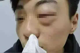 开封一中专生遭老师殴打吐血续：校方称打人者为临时工 已辞退图片