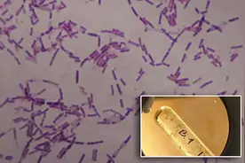 冻土层出土350万年古细菌，科学家为永生注射体内，效果如何？图片