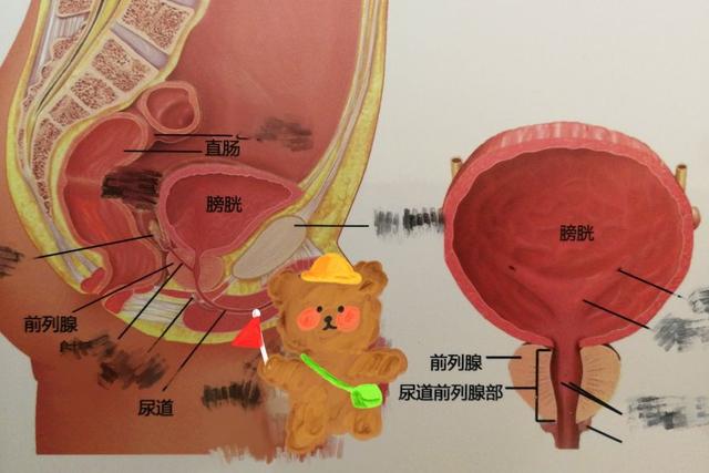 前列腺是什么样子的，它位于男性哪个部位？