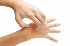 手脚经常麻木，是血液流动不畅导致？其实是身体这些疾病在作祟图片