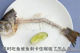 鱼刺卡喉，你还在傻傻地喝醋吞饭团吗？医生教你这样做图片