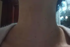 激光祛斑，点痣，祛疣安全吗，能不能做？图片