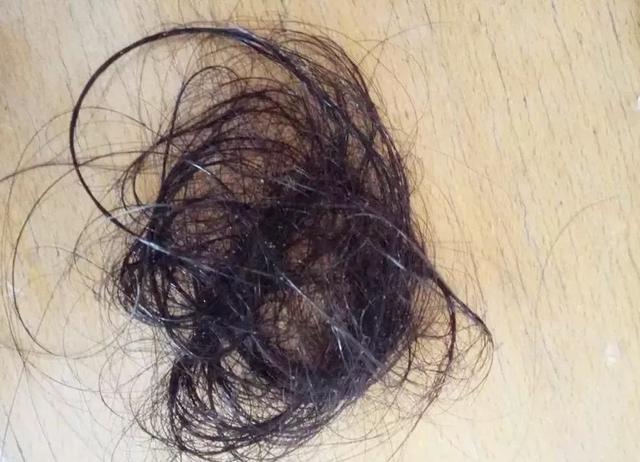 年纪轻轻就有秃顶危机？防脱发洗发水走起，秀发慢慢“柔顺亮滑”