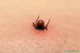 农村哪里蜱虫多，被蜱虫叮咬该怎么处置，三招可有效预防图片