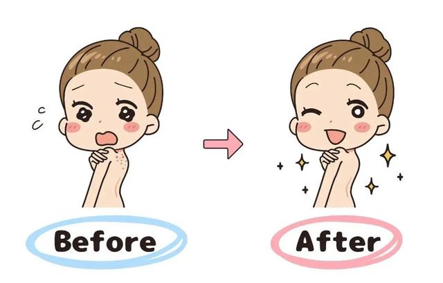 全身长鸡皮疙瘩和痘痘