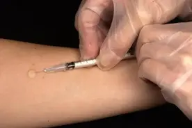 怀疑感染了结核病，应该选择哪种检测方法？图片