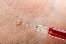 大腿根部长了不疼不痒的“肉球”，是尖锐湿疣吗？怎么处理？图片