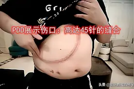 PDD肿瘤、肥胖、熬夜、久坐、抽烟喝酒嚼槟榔！这次他知错能改吗图片