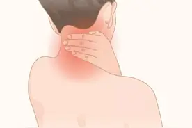 颈部痉挛的症状与缓解图片