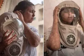 磨难！英国女对太阳过敏，竟戴面具生活二十年，每小时都要涂防晒图片