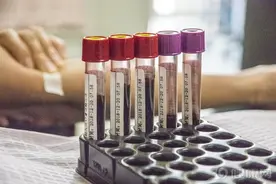 全球仅此一例！我国出现世界最罕见血型，已被国际基因库收录图片