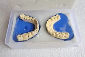 我人生第一次补牙的经历图片