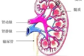 什么是肾囊肿？是否癌变或破裂？3大鉴别要点制定治疗方案图片