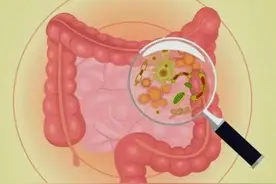 网传：人体内有3到6公斤的宿便？如何才能排出？要了解这些事图片