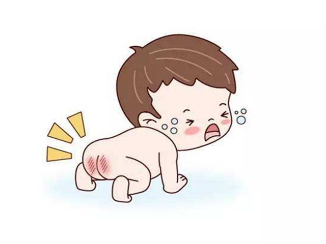 宝宝屁沟烂了怎么办