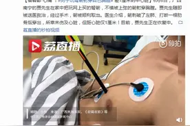 男子玩弩箭刺破自己左肺穿透身体，差1厘米就伤及心脏图片