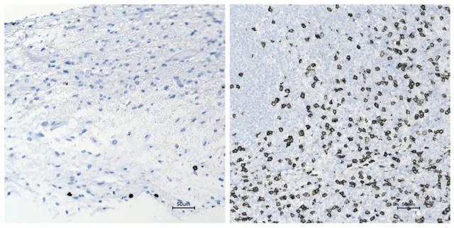 脑科学日报：人类与生俱来的尖叫声传达了至少六种情绪