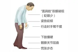 福建46岁男子以为患抑郁症，结果竟是帕金森图片