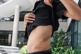 8年前，那个卖肾买苹果手机的男生，如今三级伤残、余生已经荒废图片