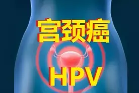 底裤若有这三个变化，也许是在提醒你感染了HPV图片