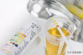 肾功能受损有哪些征兆？提醒：除了泡沫尿，这5种症状也别大意图片