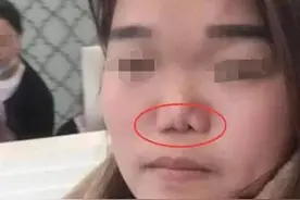 孩子"挖鼻孔"不制止，这些"隐患"终成问题，坏结局谁也不想看图片