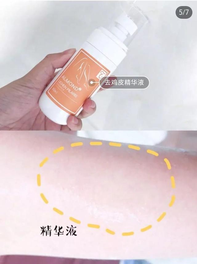 鸡皮肤啥时候能消失