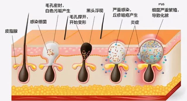 常见的美妆护肤误区，仙女们快来避坑