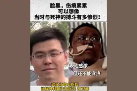 两名医生感染新冠肺炎，被救回后脸部完全变黑，原因找到了图片