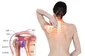 肩周炎的表现、治疗、康复、预防，只看这篇就够了图片