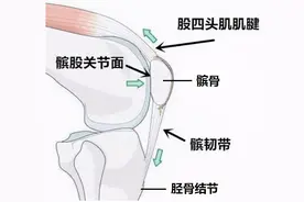 什么是髌骨软化症？是缺钙引起的吗？图片