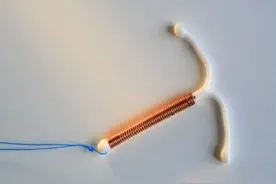 国内首批“上环”女性已步入晚年，她们如今还好吗？说不出的心酸图片