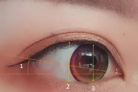 关于下睑下至，到底做还是不做？美之峰解灿告诉你图片