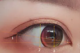 关于下睑下至，到底做还是不做？美之峰解灿告诉你图片