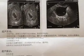 怀孕后孕囊发育很重要，多久才能看见孕囊？为什么说孕囊很重要？图片