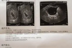 怀孕后孕囊发育很重要，多久才能看见孕囊？为什么说孕囊很重要？图片
