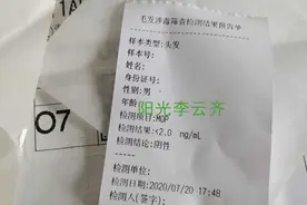 毛发测毒的标准是多少图片