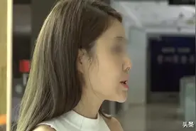 贵州一女子变美失败走上维权路：人家说我像怪物图片