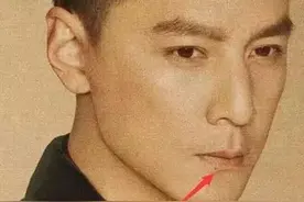 身上或颈部的小肉肉球，该如何处理？图片