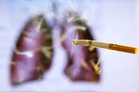 香港艺人曾伟权因患肺癌病逝   专家提醒：肺癌诊治要规范，发病警惕年轻化图片