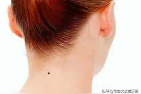 为什么很多人的脖子后面都有一颗痣？今天，我们来告诉各位答案图片