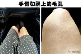被许多女性视为缺陷的9个身体特征，从科学角度来看，却很正常图片