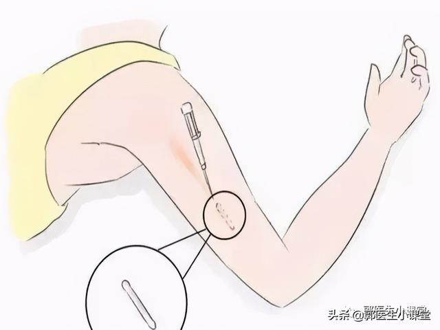 不戴套，不吃药，不上环，这个方法3分钟让你避孕5年