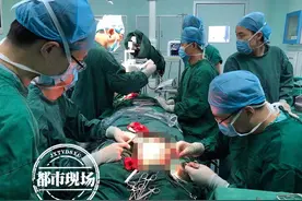 江西：男子每天烟酒不断，嘴里长出“肿块”！一半舌头被切掉图片