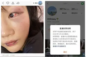 ks女网红被男友家暴！直播哭喊：救救我图片
