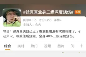 未熄灭香薰蜡烛就睡觉，网红歌手全身40%二级深度烧伤！图片