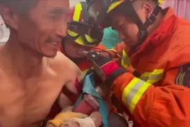 角磨机卡住手臂，皮开肉绽血肉模糊，辽宁硬汉大哥：你拆吧，我不疼！图片