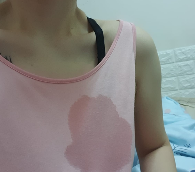 乳房溢乳是怎么回事如何治疗,突然溢乳太尴尬,这几个方法拯救哺乳期
